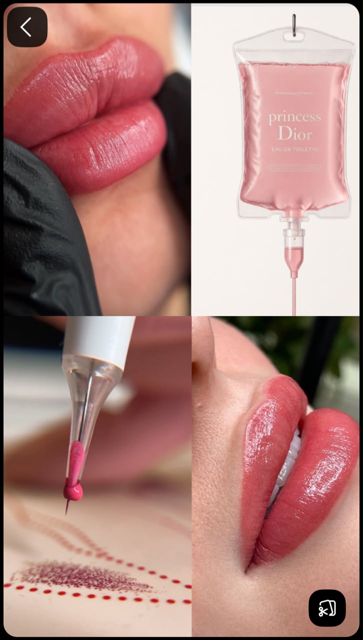 Dermopigmentation levres